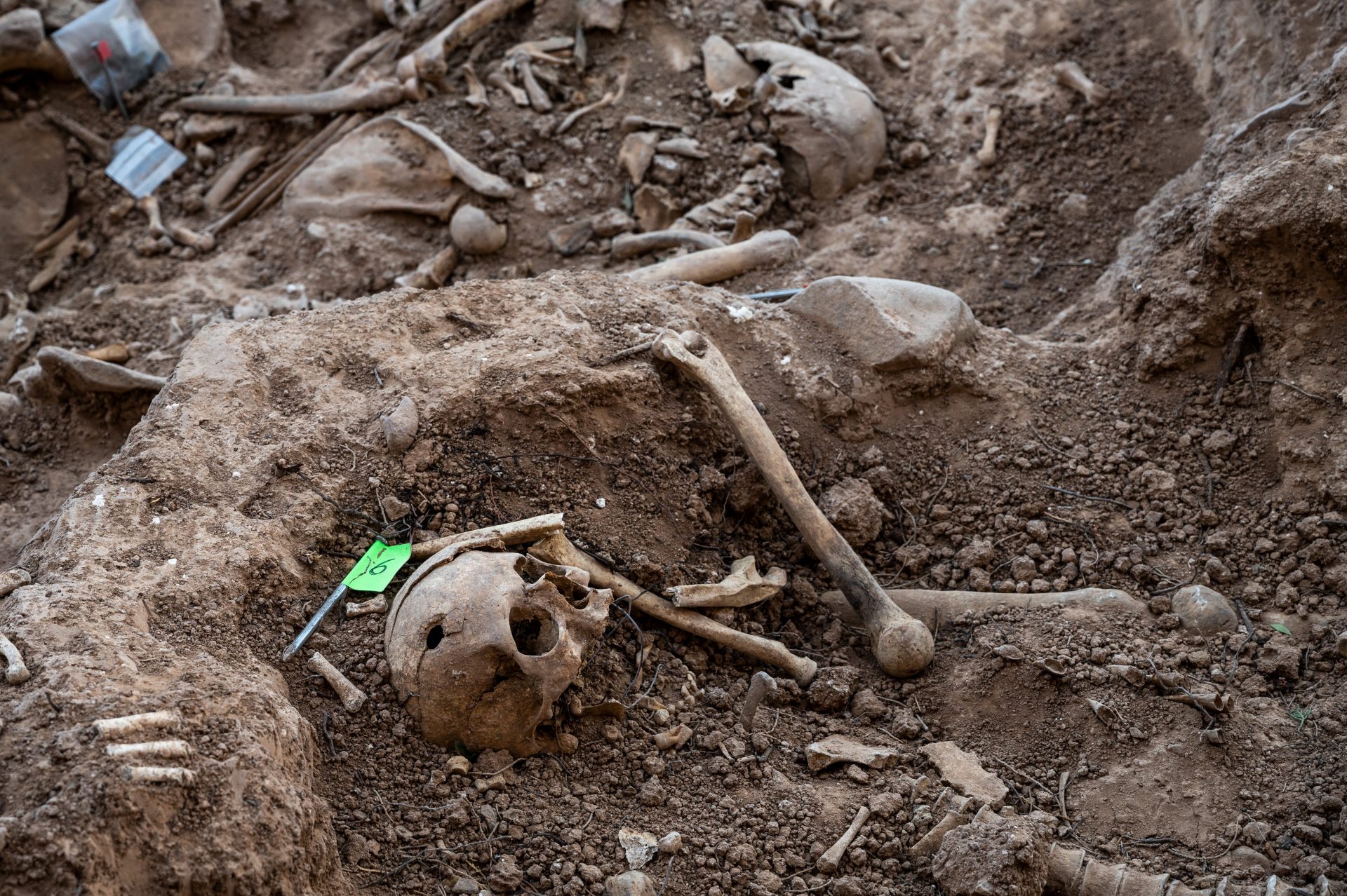 A cranium with a bullet hole is seen in a mass grave on November 15, 2021 in Belchite, Spain. A mass grave of 150 civilians killed in Belchite (Zaragoza) two days after the outbreak of the Spanish Civil War is being uncovered by scientists. (Photo by Marcos del Mazo/Getty Images)