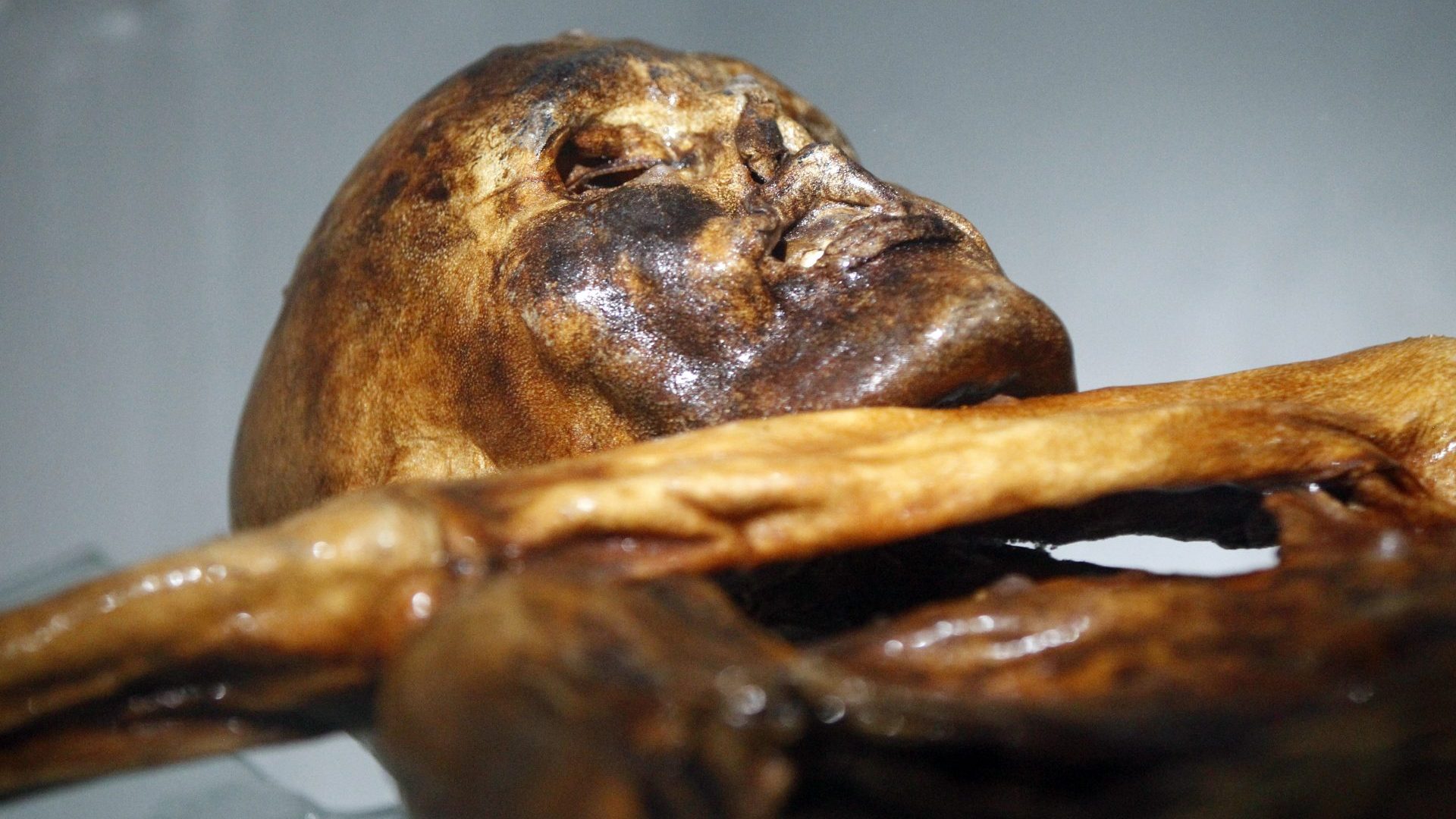 The mummy of an iceman named Otzi, discovered on 1991 in the Italian Schnal Valley glacier (Andrea Solero/AFP via Getty Images)